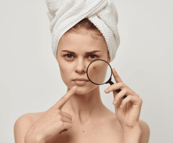Cuidados no Inverno: Hidratação Ideal para Peles Oleosas e Acneicas